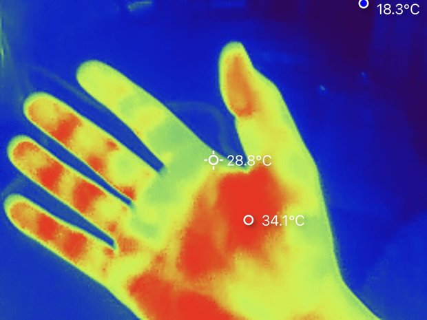 手の温度